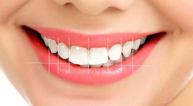 Estetik bir gülüş için ortodonti ve gülüş tasarımı