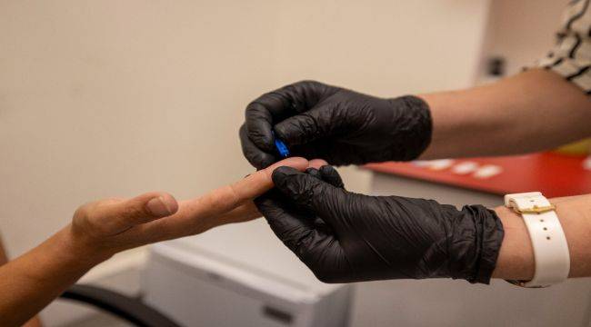 Büyükşehir’den kimliksiz ve ücretsiz test hizmeti